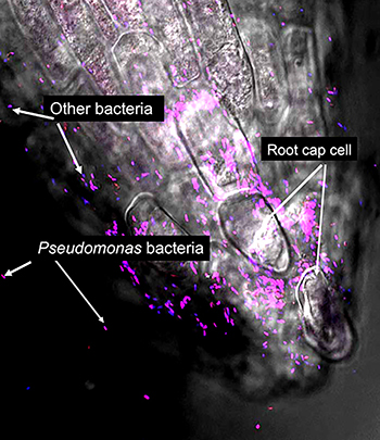 Root with bacteria