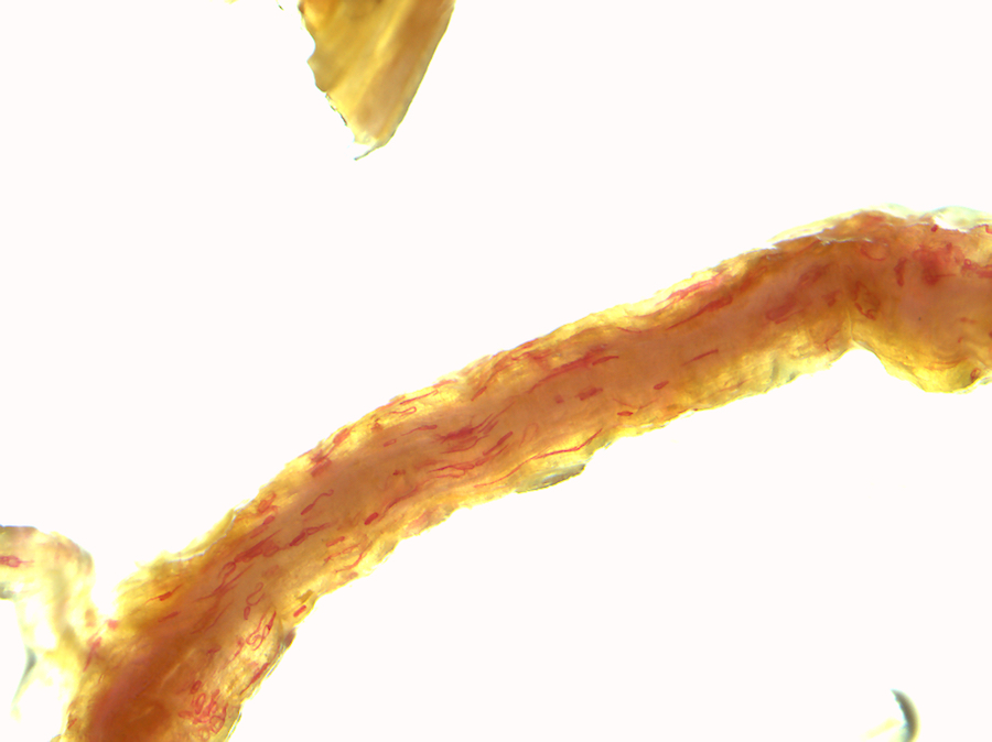 root lesion nematode